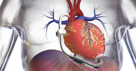 Doctors implant smallest artificial heart pump ever