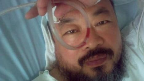 Chinese artist gets emergency brain surgery in Munich