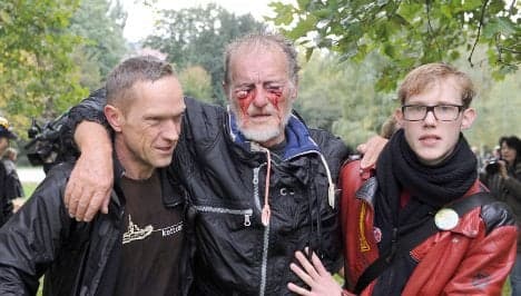 Injured Stuttgart 21 protestor could stay blind