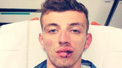 Gay man beaten in latest 'homophobic' attack