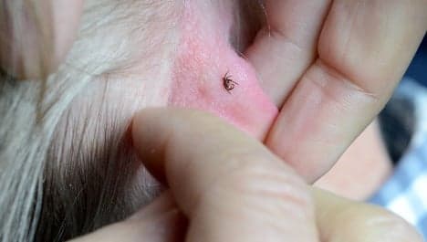 Tick bites cause blood clots: Swedish scientists