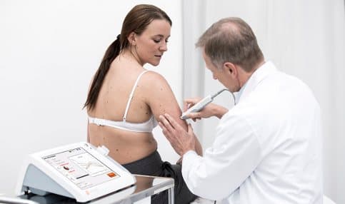 Swedes invent system to detect skin cancer