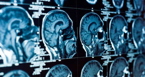Italian scientists map brain to diagnose ALS