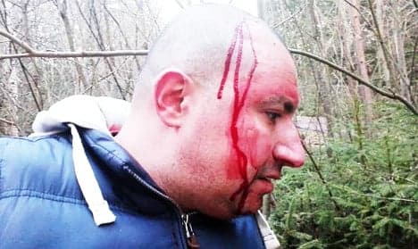 Swedish cop 'beat me up and used racial slurs'