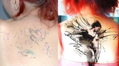 Penis tattoo victim gets cover-up design on back