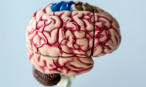 Long-term damage seen from brain injuries: Swedish study