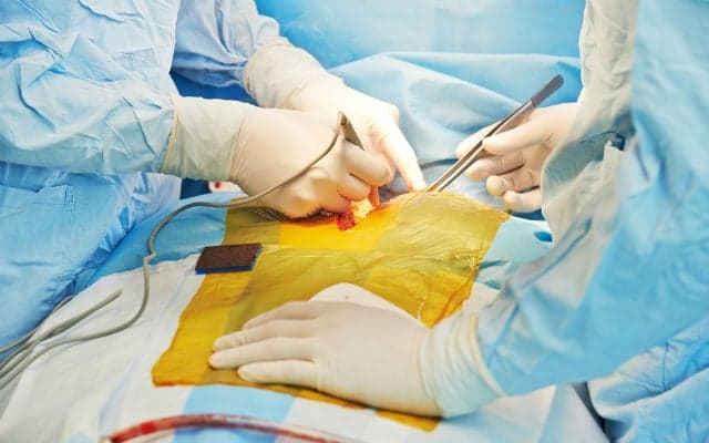 Italian doctors implant first artificial esophagus