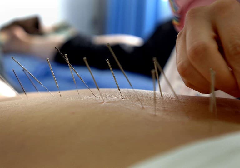 Spain wants to ban acupuncture and homeopathy