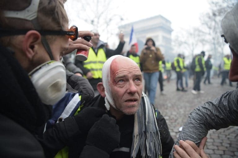 French police blasted for maiming 'yellow vests' with tear gas and rubber bullets
