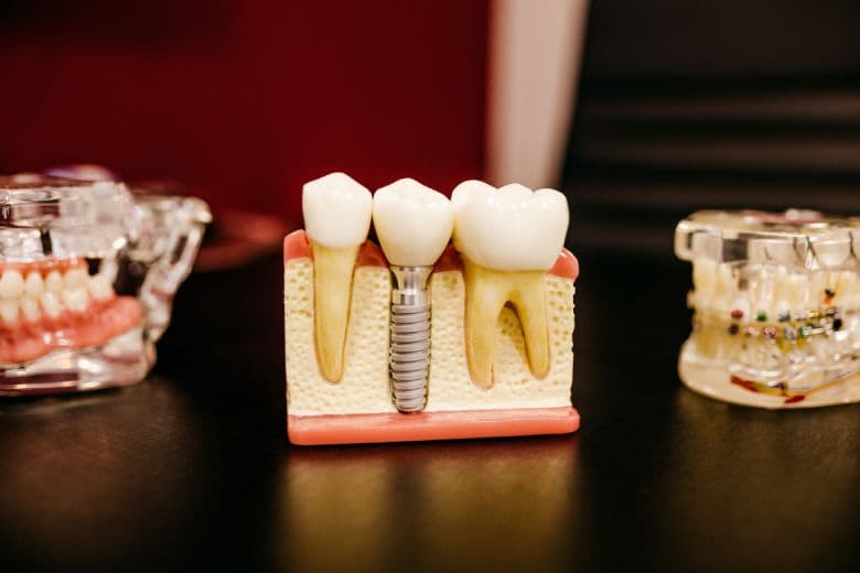 Rising prices force Danes to postpone dental appointments