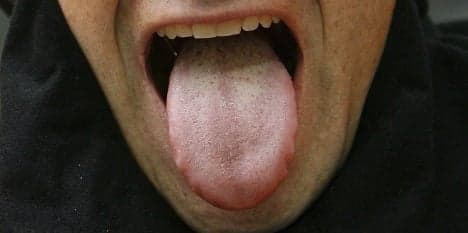 Myth-testing teenager injures tongue on chilly lamppost