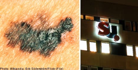 Swedish doc missed 27 skin cancer cases