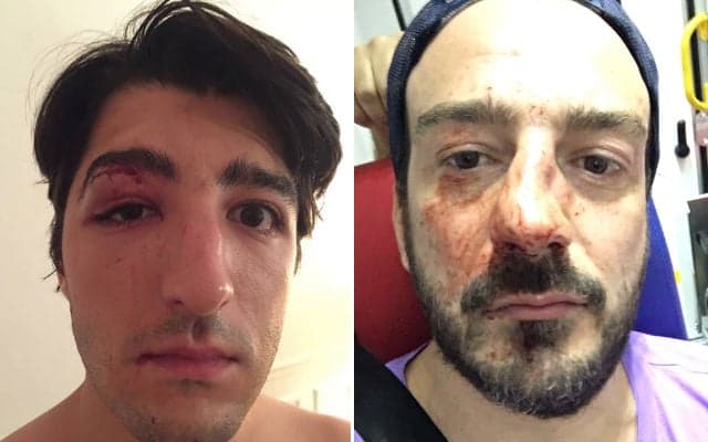 'l'm gay and this is 2018': Paris left shocked by another homophobic attack