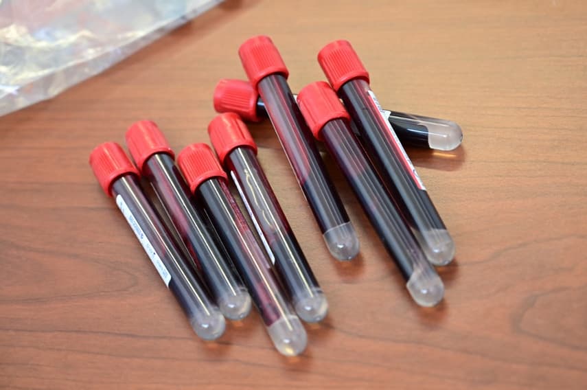 Lombardy begins trialling coronavirus immunity blood tests