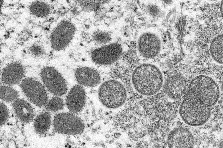 Sweden registers first confirmed case of monkeypox