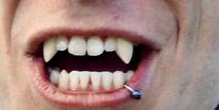 German insurer warns against growing vampire teeth trend