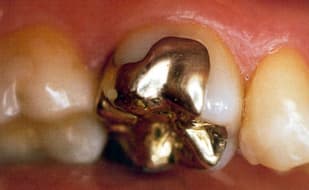Crematorium probe exposes harvesting corpses for gold teeth