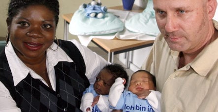 Berlin twins born with different skin tones