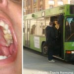 Uppsala man bloodied in biting bus driver beating