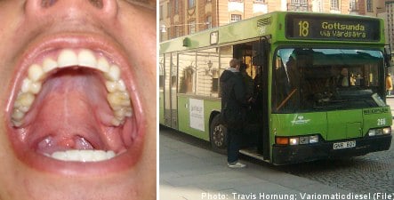 Uppsala man bloodied in biting bus driver beating