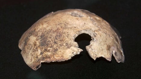 Russia's ‘Hitler skull’ belonged to a woman