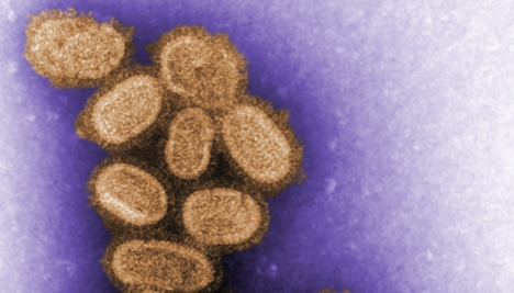 First suspected swine flu death in Germany
