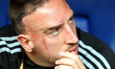 France using Ribery as 'scapegoat,' Bayern Munich boss says