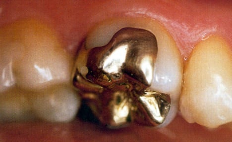 Crematorium probe exposes harvesting corpses for gold teeth