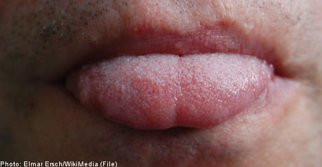Swedish woman wakes to find stranger’s tongue on her arm