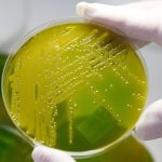 Hunt for source of deadly E. coli source continues