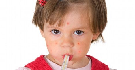 Alarm as measles cases skyrocket