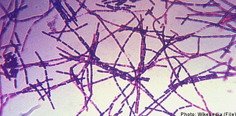 Outbreak prompts probe of old anthrax cases