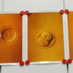 Gene tests for IVF embryos legalised