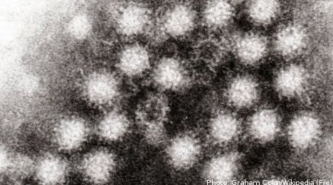 Researchers nearing Norovirus treatment in Sweden