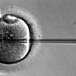 Swedish model slashes multiple-birth risk in IVF pregnancies