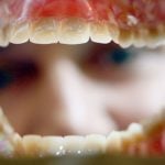 Dentures go missing after ex-couple’s spat