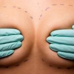 Sweden mulls ban on boob job jabs
