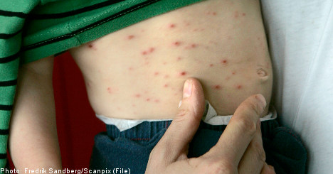 Rubella blamed for Swedish infant’s defects