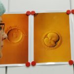 First German DNA screen baby born healthy