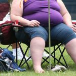 Gastric bypass surgery cuts risk of death: study