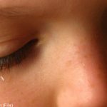 Kids’ eyes glued shut by Swedish docs