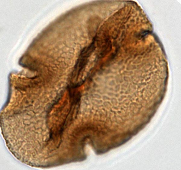 Blast from the past<br>A 52-million-year-old pollen grain produced by ancestors of today’s tropical Baobab trees. Photo: Lineth Contreras