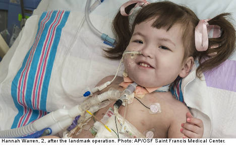 Two-year-old girl gets windpipe made from stem cells