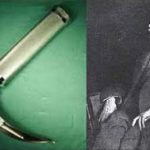 In 1854, Spanish vocal pedagogist Manuel García became the first man to view the functioning glottis and larynx in a living human with the help of a handy laryngoscope blade. Although some historians credit English physician Benjamin Guy Babington with creating a similar device called the "glottiscope", García developed a tool that used two mirrors for which the sun served as an external light source.Photo: publico.es