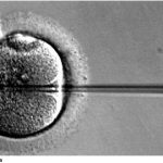 IVF linked to risk of mental disability: study