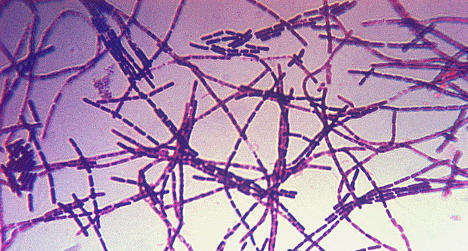 Bleeding cadaver leads to Swedish anthrax find