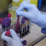 Spain to trial promising HIV treatment