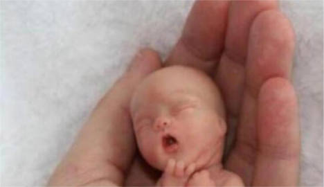 Fake foetus pic inflames Norway abortion debate