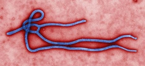Two new suspected Ebola cases in Austria