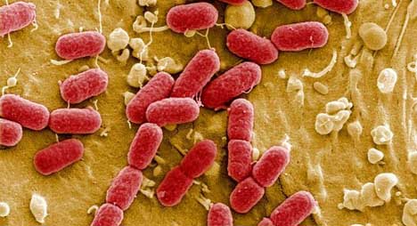 Legionnaire’s disease kills two more in Spain